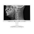Écran pour diagnostics cliniques