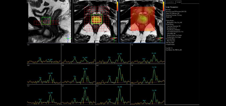 Spectroscopy Imaging