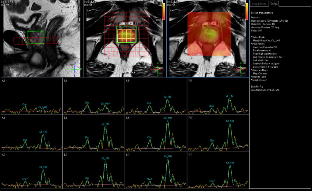 Spectroscopy Imaging