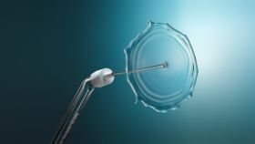 Compact Flosser 1000