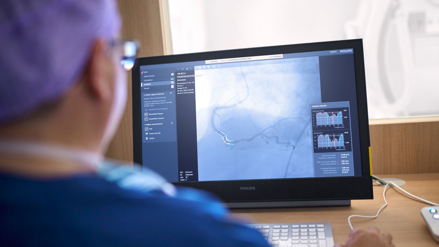 Philips Azurion 3 — Параллельная работа операционной и пультовой