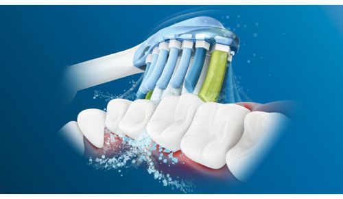 Philips Sonicares avancerede soniske teknologi