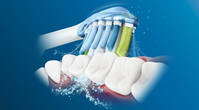 Die fortschrittliche Philips Sonicare-Schalltechnologie