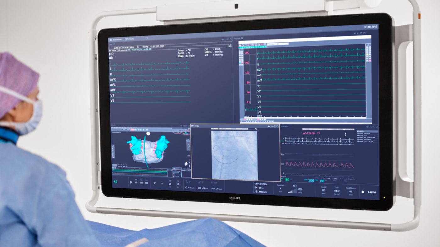 Philips Azurion 3 — FlexVision: до 20 источников на одном экране