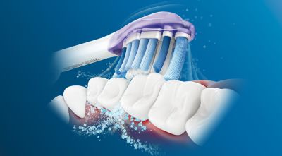 Philips Sonicare's advanced sonic technology