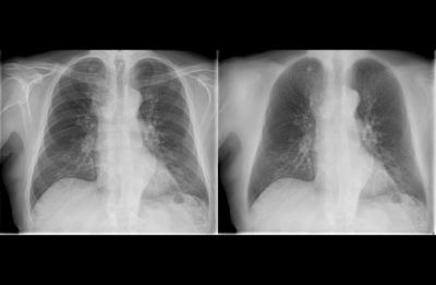 Bildverarbeitungstechnologie f&uuml;r bessere Qualit&auml;t klinischer Bilder​