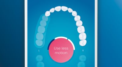 Guides your brushing and highlights missed areas