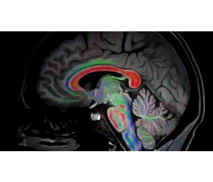 Diffusion Excellence Pack - Brain 