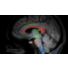 Diffusion Excellence Pack - Brain  thumbnail