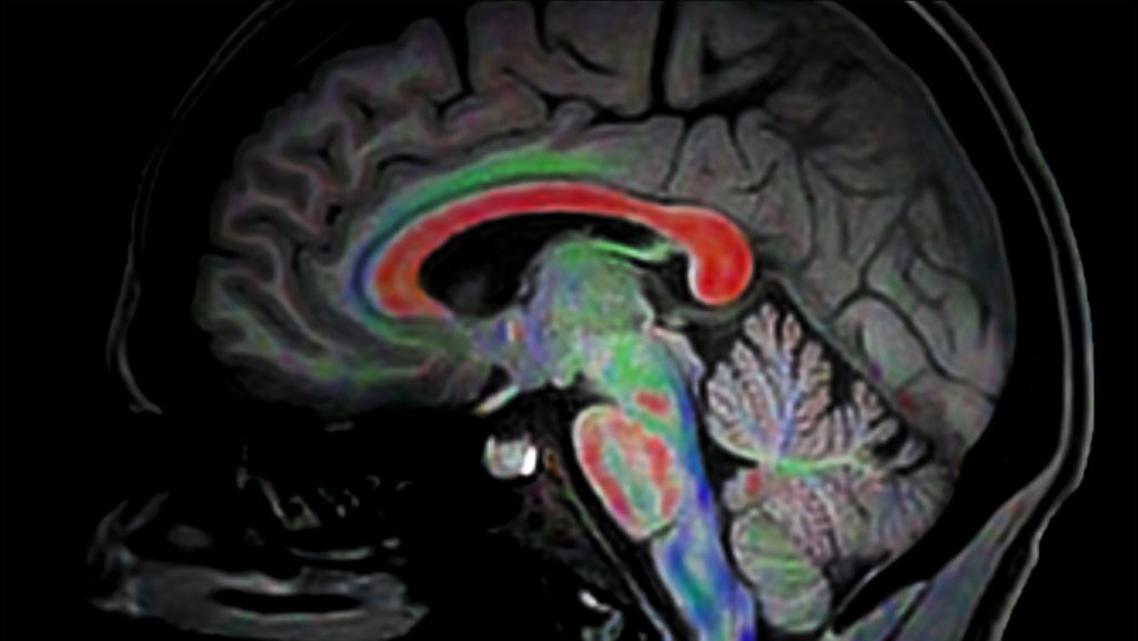 Diffusion Excellence Pack - Brain