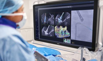 physician using deviceguide with echonavigator