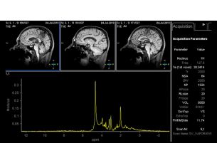 Spectroscopy XD MR Clinical application