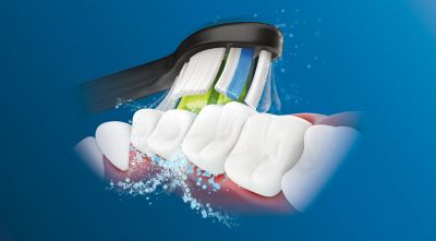 Philips Sonicare geavanceerde sonische technologie