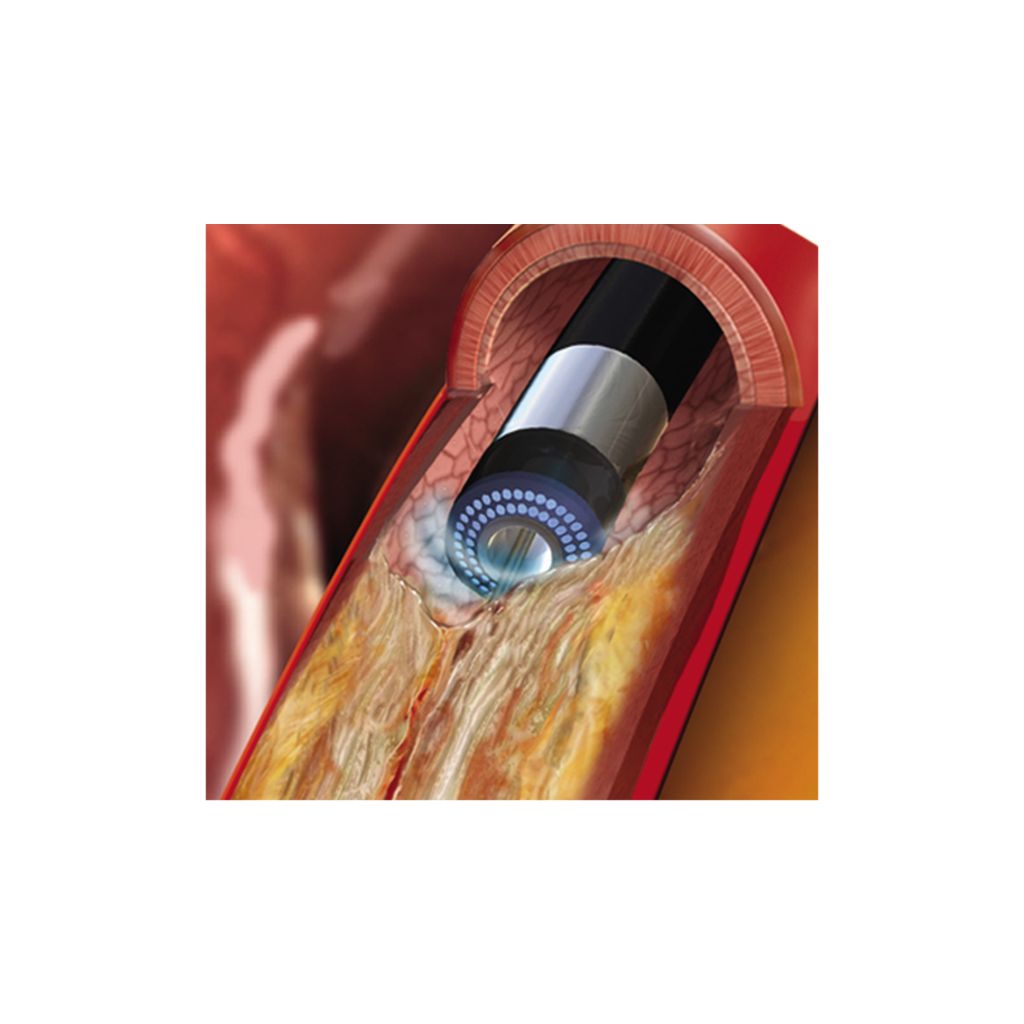 Coronary procedures