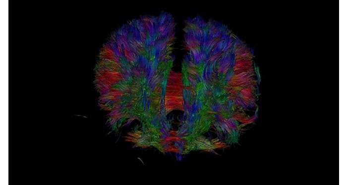 NeuroScience extension MR Clinical application | Philips