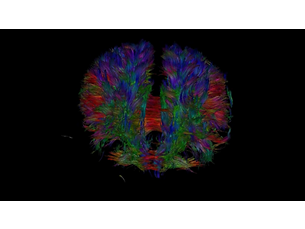 NeuroScience Erweiterung Klinische MR-Anwendung