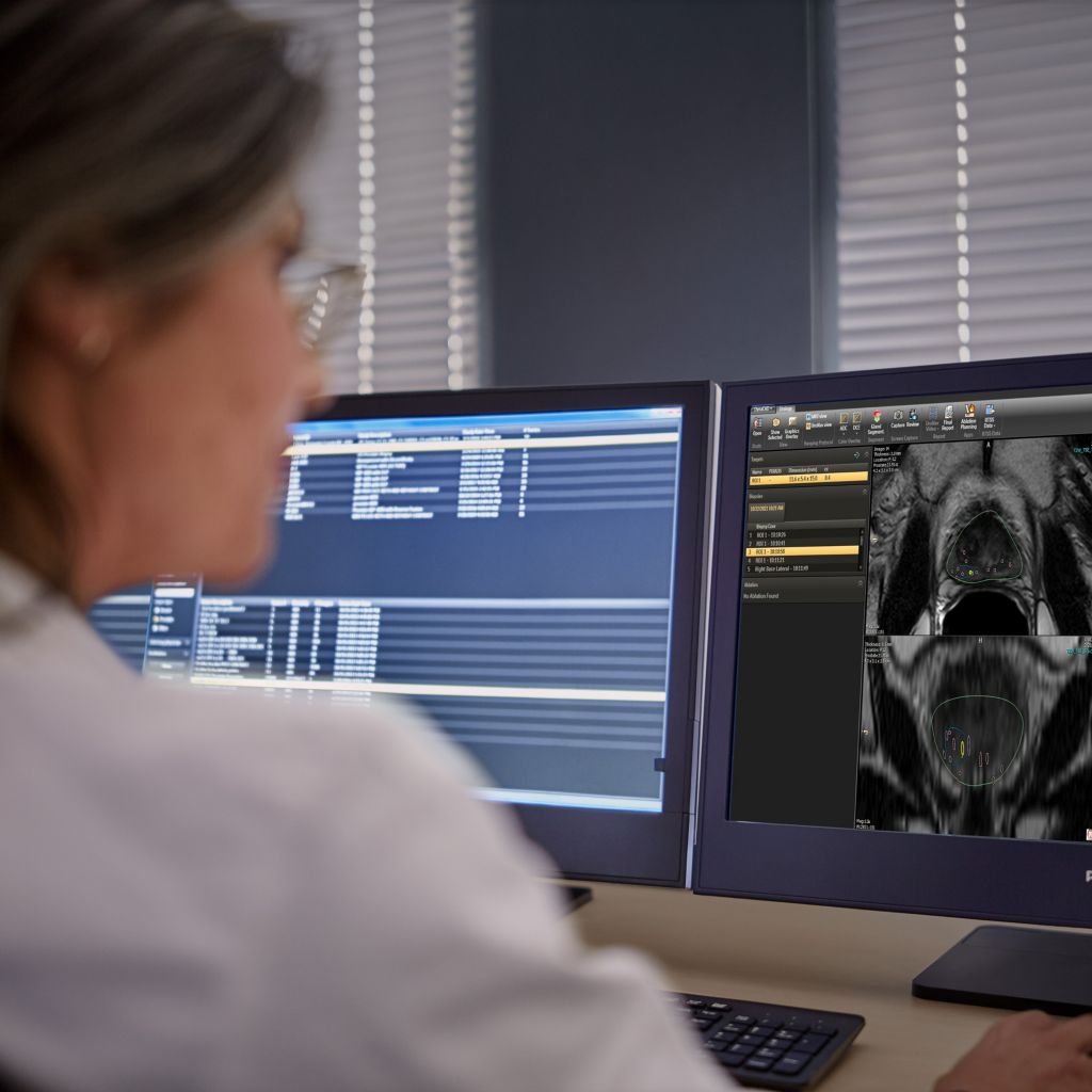 DynaCAD Urology diagnostic