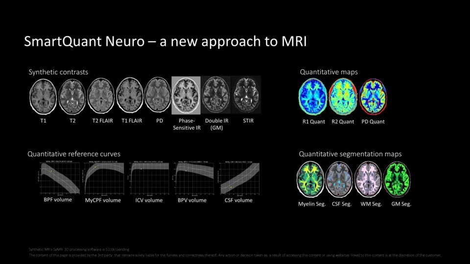 Smart Quant clinical image