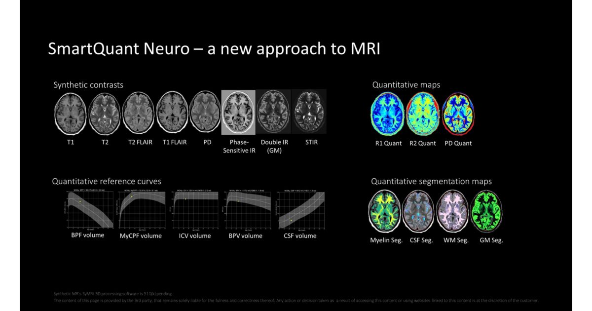 New standards in neuro MR quantification - Philips