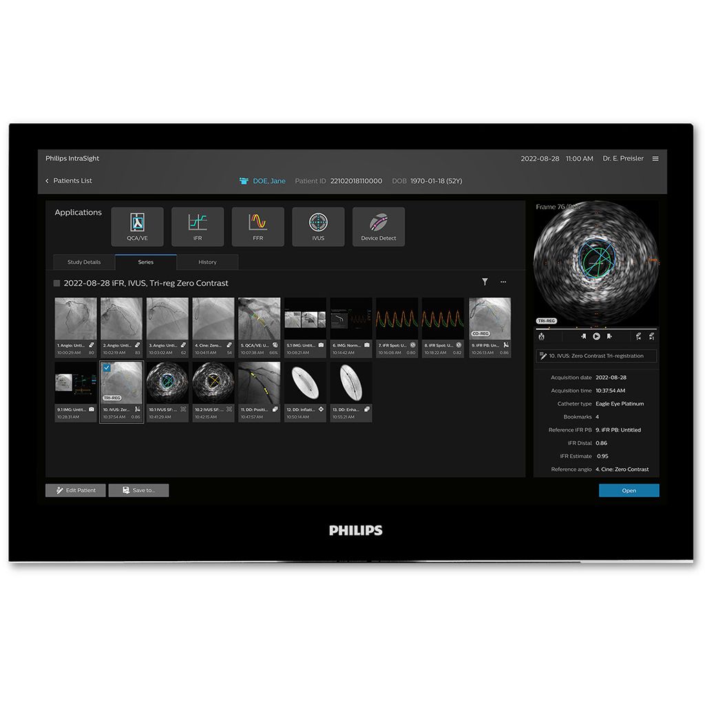Zero-contrast workflow