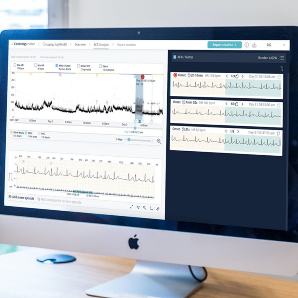 Cardiologs Expert Corner EHRA