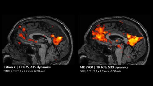 fMRI Comparison