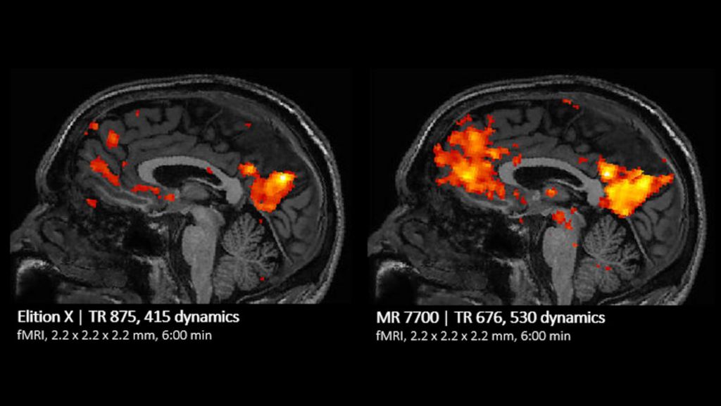 fMRI Comparison