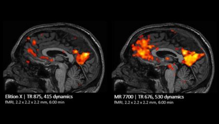 fMRI Comparison