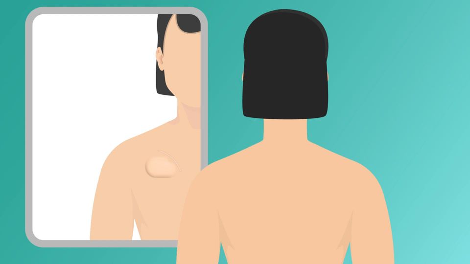 HRM patient animated