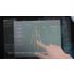 Philips Zenition - Dose Management video thumbnail
