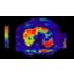 MR Elastography Extension clinical application thumbnail