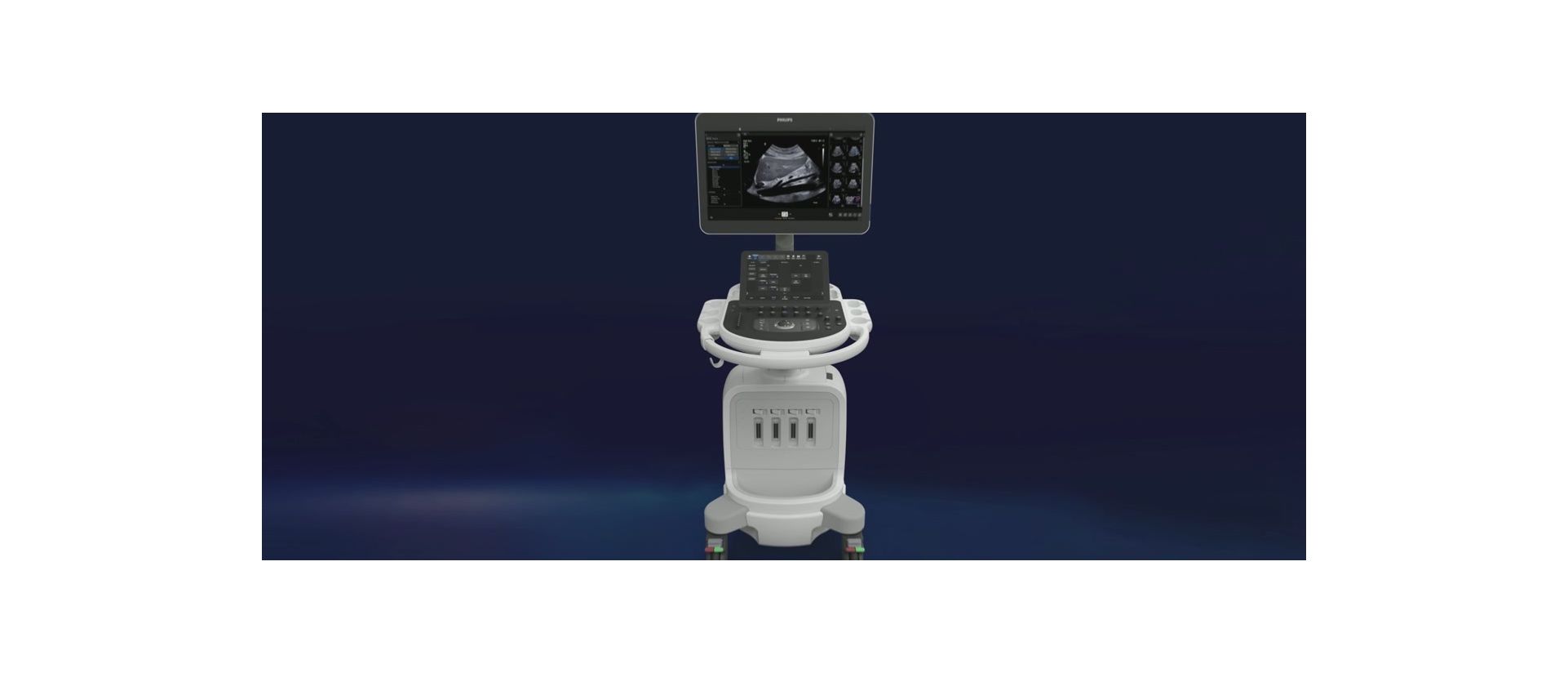 Elevate every ultrasound experience … Expertly.