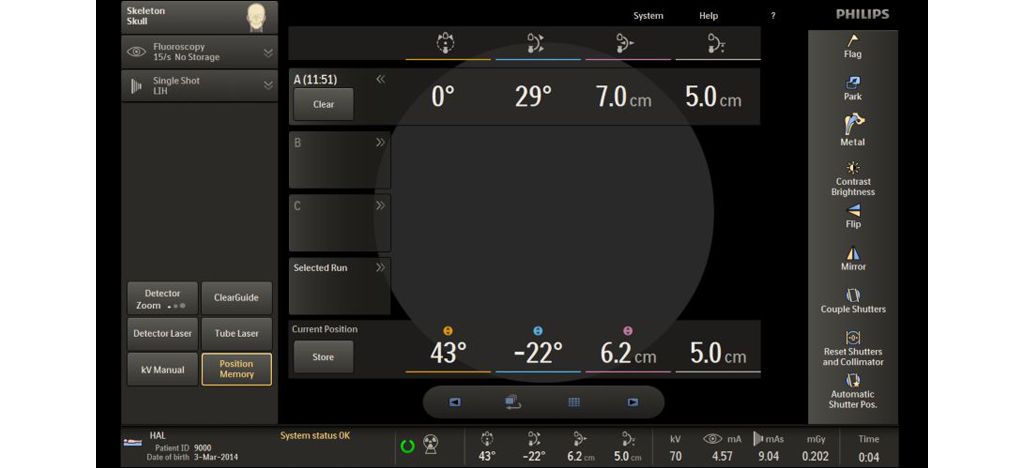 Reduce repositioning time by up to 42% through the Position Memory feature²
