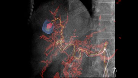 MRI-like lesion detection in your lab