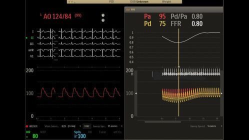 User interface - FFR exam room