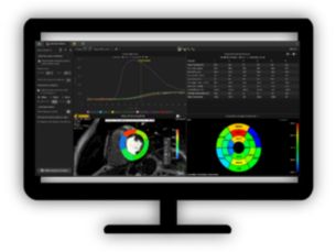 MR Cardiac Temporal Enhancement (Perfusion) Support assessing temporal enhancements of the myocardium