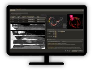 CT Comprehensive Cardiac Analysis (CCA) 
