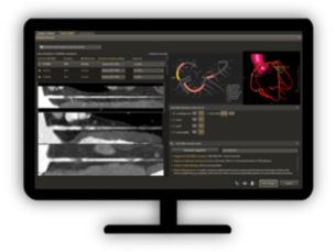 CT Comprehensive Cardiac Analysis (CCA) Comprehensive cardiac analysis supported by automatic workflow steps