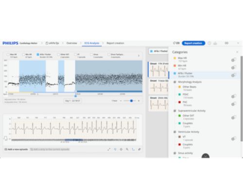 Holter algorithm