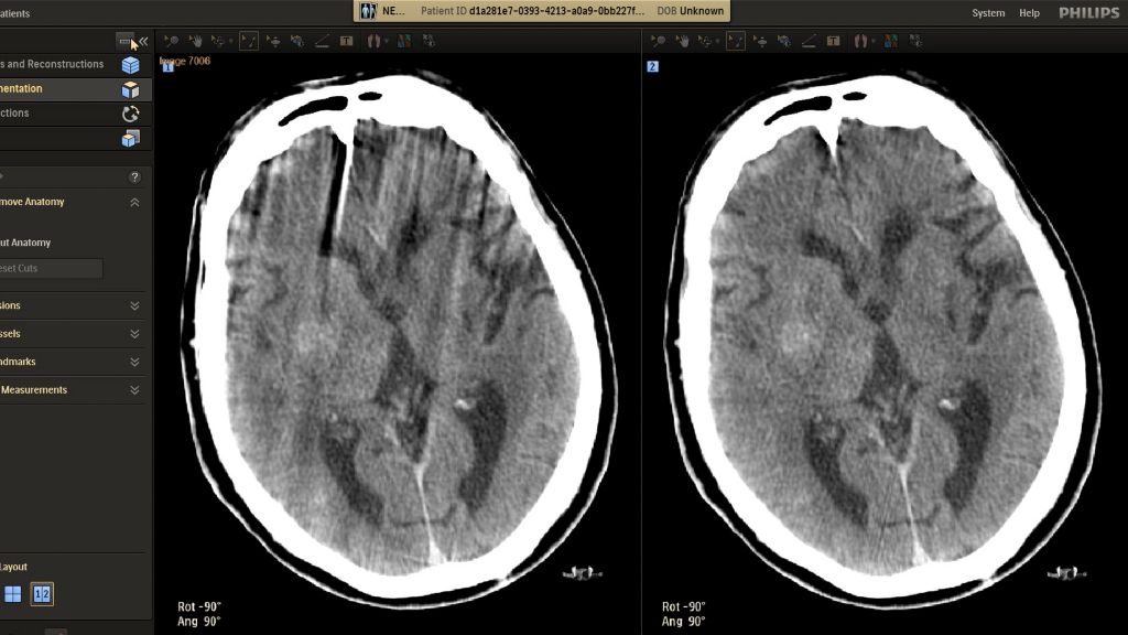 SmartCT Soft Tissue Helical
