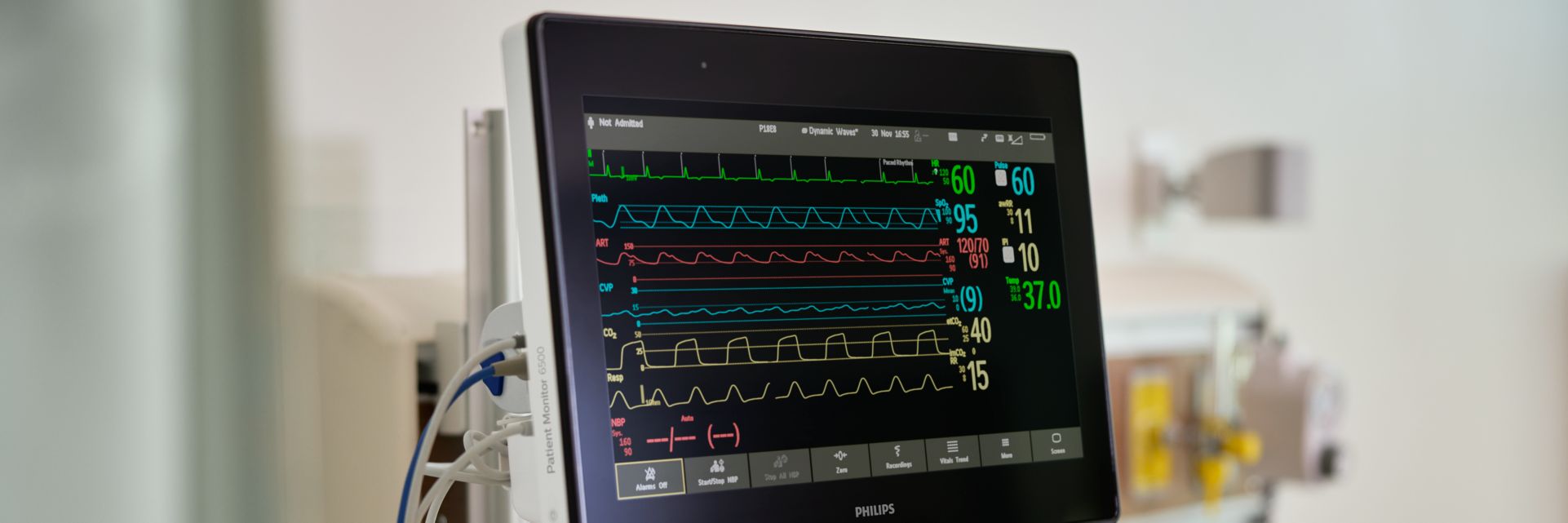 Patient Monitor 6500 mounted on wall