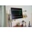 Patient Monitor 6500 867315 IntelliVue Patient Monitor 6500