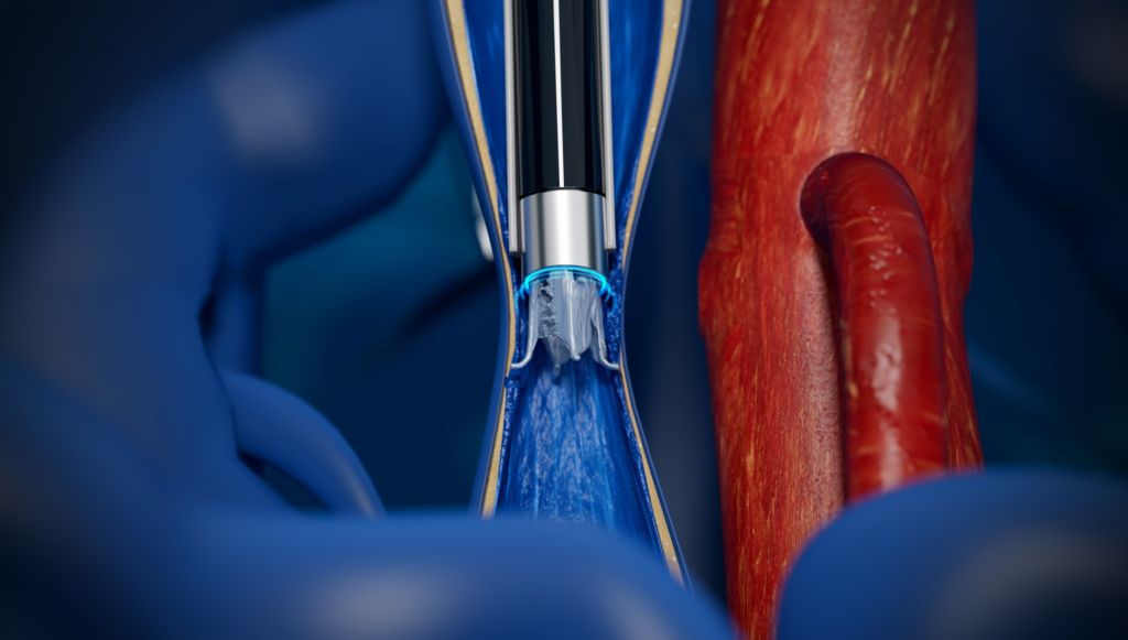 Breakthrough Device Designation is an FDA program for innovative medical devices that provides a pathway for expedited review of a more effective treatment or diagnosis of life-threatening or permanently debilitating diseases.