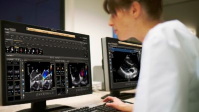 Profissional de saúde analisando imagens cardíacas e dados clínicos nas estações de trabalho Philips Enterprise Imaging