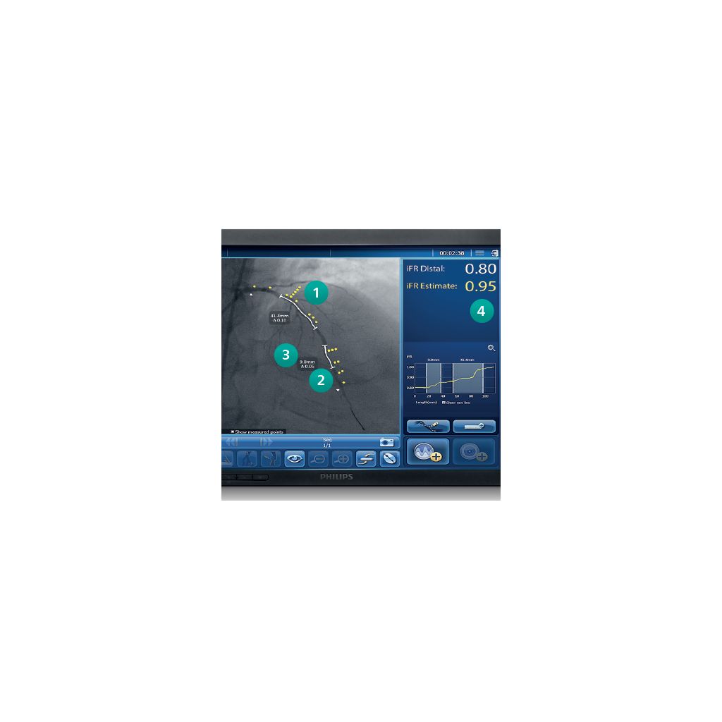 Visual showing guidance on whether to treat and where to treat 