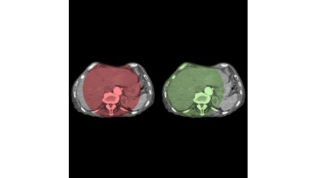 CBCT Open for wider visualization​