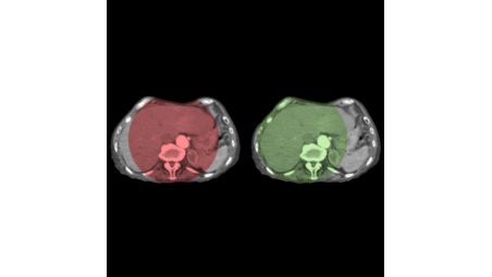 CBCT ouvert