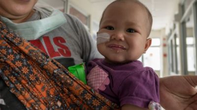 Smiling infant with medical bandage on cheek in hospital