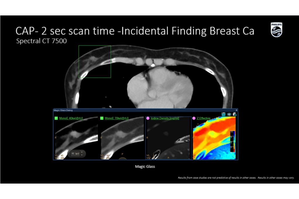 CT Spectral 7500 Scan time