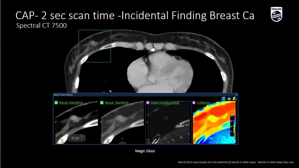 CT Spectral 7500 Scan time